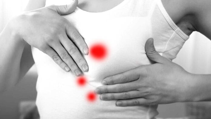 How-to-detect-breast-cancer How-to-Reduce-Risk-of-Breast-Cancer