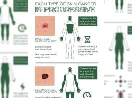 Save-Your-Skin-FromHow-to-Detect-Skin-Cancer-triggers-treatment