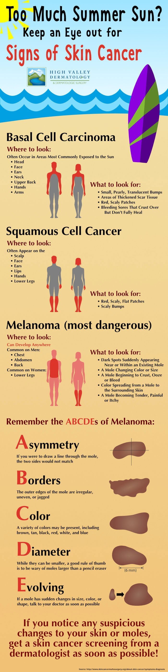 how-to-avoid-skin-cancer-during-summer-infographic