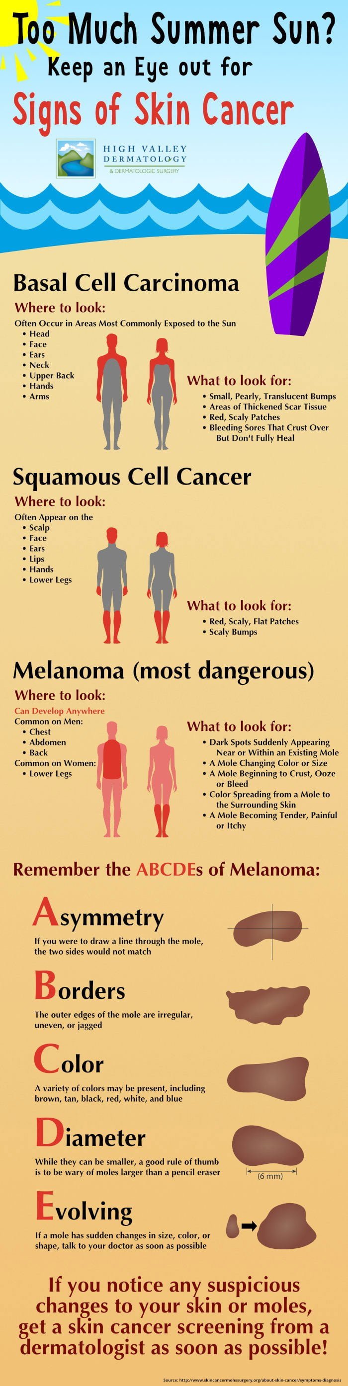How to avoid skin cancer/melanoma during summer how-to-avoid-skin-cancer-during-summer-infographic