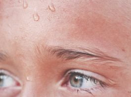 effective-measures-against-abundant-sweating