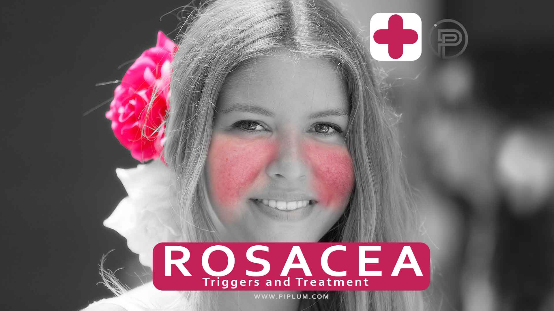 rosacea-treatment-triggers-drugs-redness-flush-healing-medicine