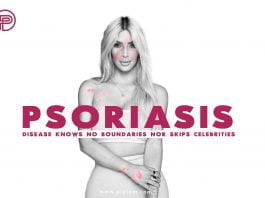 Kim-Kardashian-Psoriasis-treatment-methods