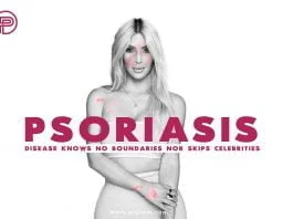 Kim-Kardashian-Psoriasis-treatment-methods