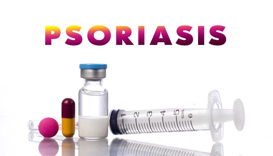 Psoriasis-biological-treatment-usually-affects-the-immune-system